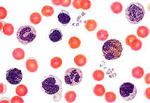 Blutzellen durch Software-Linsen dargestellt