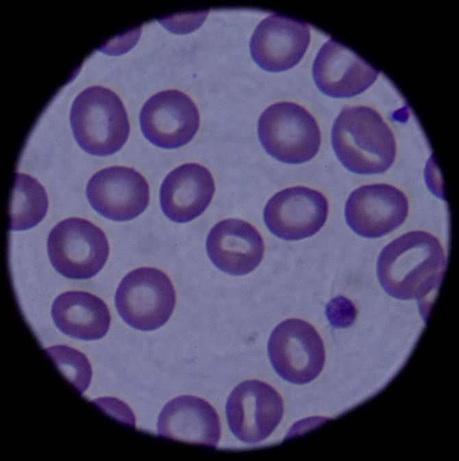 English: Red and white blood cells are shown t...